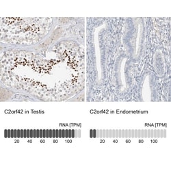 C2orf42 Antibody, Novus Biologicals 0.1mL; Unlabeled:Antibodies, Polyclonal